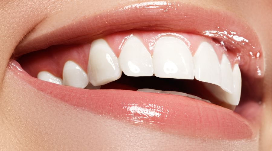 Best Dental Implants in Turkey