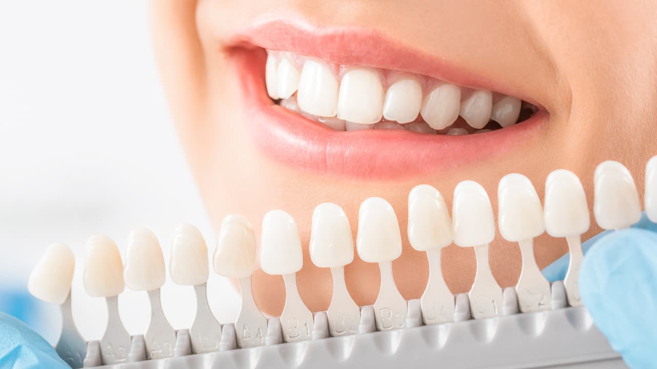 Dental Implants Antalya - Turkiye