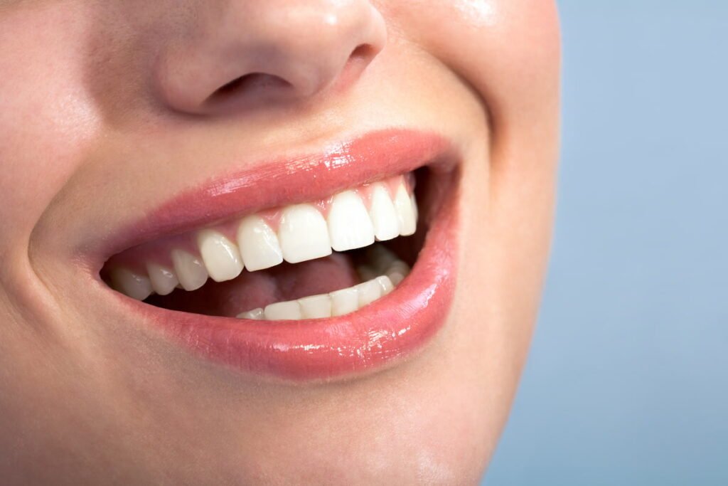 Happy Female Healthy-teeth-shown-inSmile Dental Centre Turkey